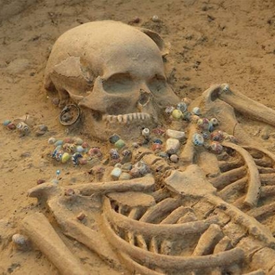 materiel-laboratoire-squelette-etude-abemus-centrale-achat-archeologie